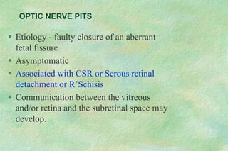  Etiology - faulty closure of an aberrant
fetal fissure
 Asymptomatic
 Associated with CSR or Serous retinal
detachment or R’Schisis
 Communication between the vitreous
and/or retina and the subretinal space may
develop.
OPTIC NERVE PITS
 
