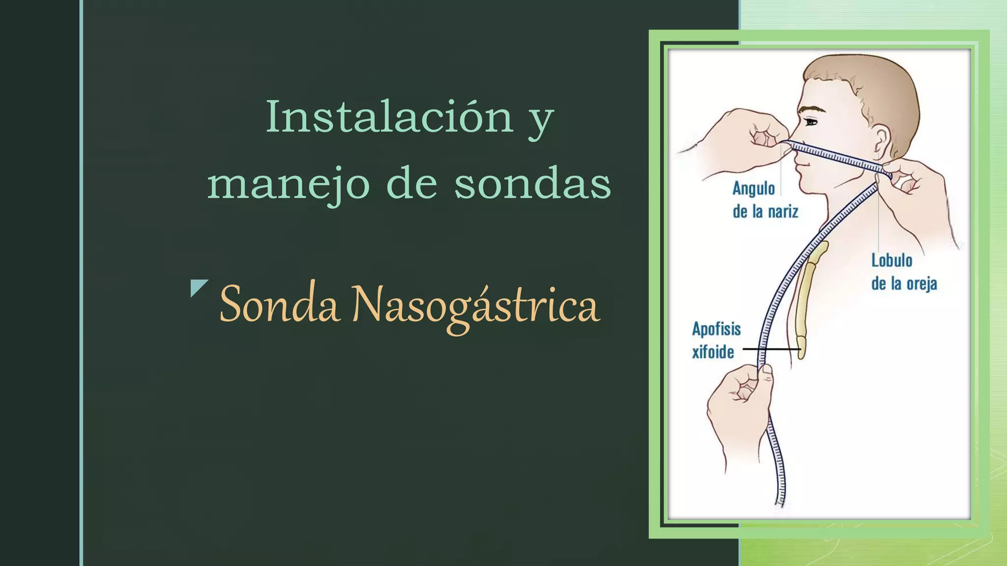 Colocación de Sonda Nasogastrica.pptx