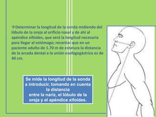 Se mide la longitud de la sonda
a introducir, tomando en cuenta
la distancia
entre la nariz, el lóbulo de la
oreja y el apéndice xifoides.
Determinar la longitud de la sonda midiendo del
lóbulo de la oreja al orificio nasal y de ahí al
apéndice xifoides, que será la longitud necesaria
para llegar al estómago; recordar que en un
paciente adulto de 1.70 m de estatura la distancia
de la arcada dental a la unión esofagogástrica es de
40 cm.
 