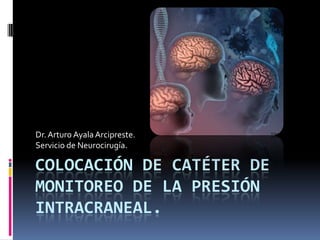 COLOCACIÓN DE CATÉTER DE
MONITOREO DE LA PRESIÓN
INTRACRANEAL.
Dr.Arturo AyalaArcipreste.
Servicio de Neurocirugía.
 