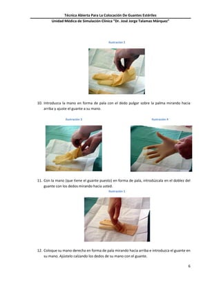 Técnica Abierta Para La Colocación De Guantes Estériles
Unidad Médica de Simulación Clínica “Dr. José Jorge Talamas Márquez”
6
Ilustración 2
10. Introduzca la mano en forma de pala con el dedo pulgar sobre la palma mirando hacia
arriba y ajuste el guante a su mano.
Ilustración 3 Ilustración 4
11. Con la mano (que tiene el guante puesto) en forma de pala, introdúzcala en el doblez del
guante con los dedos mirando hacia usted.
Ilustración 5
12. Coloque su mano derecha en forma de pala mirando hacia arriba e introduzca el guante en
su mano. Ajústelo calzando los dedos de su mano con el guante.
 