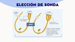 ELECCIÓN DE SONDA
 