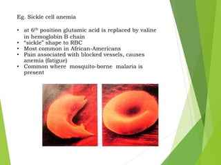 Eg. Sickle cell anemia
• at 6th position glutamic acid is replaced by valine
in hemoglobin B chain
• “sickle” shape to RBC
• Most common in African-Americans
• Pain associated with blocked vessels, causes
anemia (fatigue)
• Common where mosquito-borne malaria is
present
 