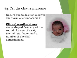 Eg. Cri du chat syndrome
• Occurs due to deletion of lower
short arm of chromosome #5
• Clinical manifestations:
moon shaped face, cry with a
sound like new of a cat,
mental retardation and a
number of physical
abnormalities.
 