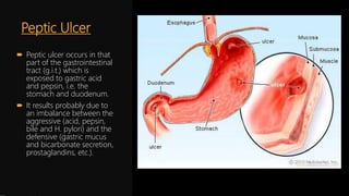 Antacids and antiulcer drugs | PPTX