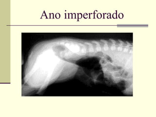 Ano imperforado 