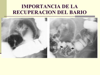 IMPORTANCIA DE LA RECUPERACION DEL BARIO 