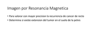 Imagen por Resonancia Magnetica
• Para valorar con mayor precision la recurrencia de cancer de recto
• Determina si existe extension del tumor en el suelo de la pelvis
 