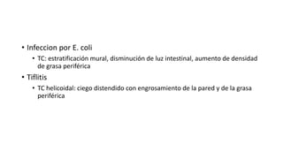 • Infeccion por E. coli
• TC: estratificación mural, disminución de luz intestinal, aumento de densidad
de grasa periférica
• Tiflitis
• TC helicoidal: ciego distendido con engrosamiento de la pared y de la grasa
periférica
 