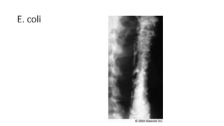 E. coli
 