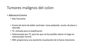 Tumores malignos del colon
• Adenocarcinoma
• Mas frecuente
• Enema de bario de doble contraste: masa polipoide, anular, de placa o
ulcerada
• TC: utilizada para la etapificacion
• Colonoscopia por TC: para los que no fue posible valorar el ciego en
colonoscopia normal
• IRM: proporciona una excelente visualización de la fascia mesorecta
 