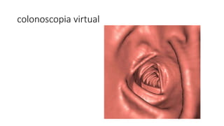 colonoscopia virtual
 
