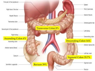 carcinoma of the COLON and its management.pptx