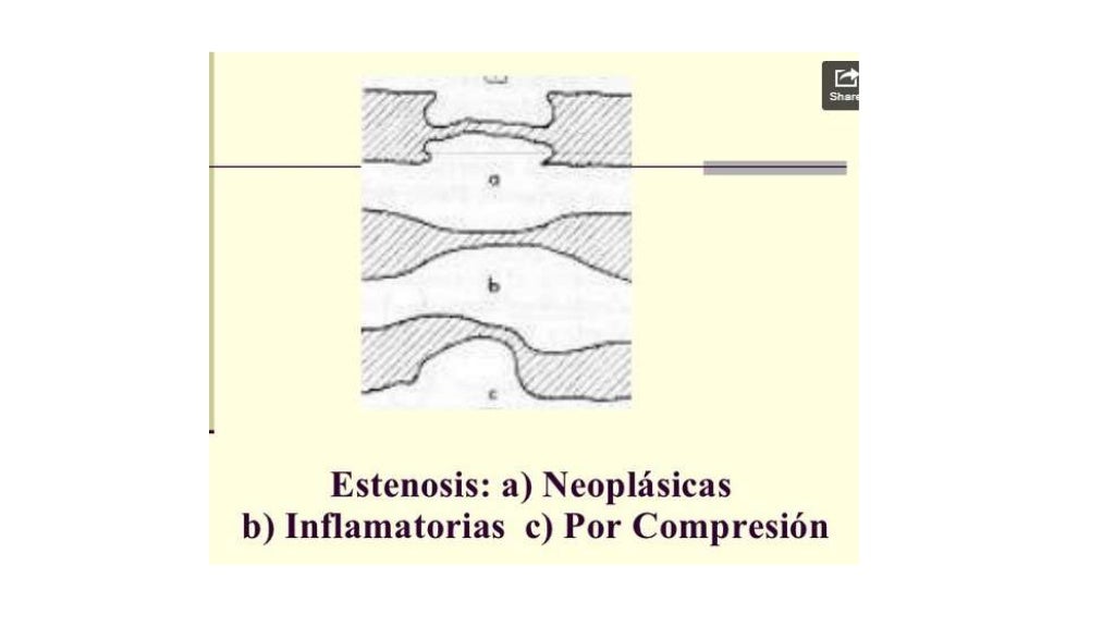 doble contraste en radiologia doble contraste en radiologia