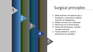 Surgical principles
1. Wide resection of involved colon +
lymphatics + mesocolon +enblock
resection of neiboghring
2. Margin around 5 cm is adequate
3. Mininmum of 12 LN for biopsy
4. Postive LN left beyond , consider
inproper resection
5. Inspect abdomen , viserca ,
peritoneum for any Mets
5
4
3
2
1
 