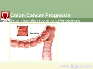 Colon Cancer Prognosis www.ipgdx.com Better information sooner for better decisions 