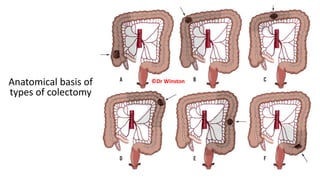 Anatomical basis of
types of colectomy
©Dr Winston
 