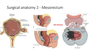 Surgical anatomy 2 - Mesorectum
©Dr Winston
 