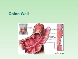 Colon Wall
 