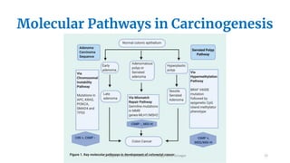 COLON CANCER- An Evidence based management | PDF