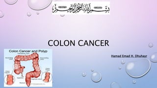 Colon cancer