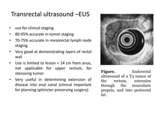 Transrectal ultrasound –EUS
• use for clinical staging.
• 80-95% accurate in tumor staging
• 70-75% accurate in mesorectal lymph node
staging
• Very good at demonstrating layers of rectal
wall
• Use is limited to lesion < 14 cm from anus,
not applicable for upper rectum, for
stenosing tumor
• Very useful in determining extension of
disease into anal canal (clinical important
for planning sphincter preserving surgery)
Figure. Endorectal
ultrasound of a T3 tumor of
the rectum, extension
through the muscularis
propria, and into perirectal
fat.
 