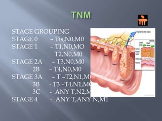 COLON CANCER STAGINGDUKES CLASSIFICATION A – Tumor restricted to but not through            bowel wall. B – Penetration through the bowel wall C – Spread to local & regional nodes        C1 – Local lymph nodes involved        C2 -  lymph nodes at point of ligation  D – Distant metasatses