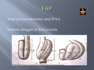 PROPHYLACTIC SURGERY POLYPSFirst consider non surgical management options before surgeryEndoscopic polypectomy         reduces the incidence of subsequent         cancer 50 – 70 %