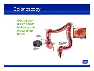 Colonoscopy
Colonoscopy
allows doctor
to directly see
inside entire
bowel
 