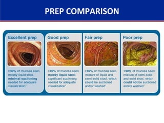 PREP COMPARISON
 