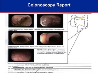 Colonoscopy Report
 