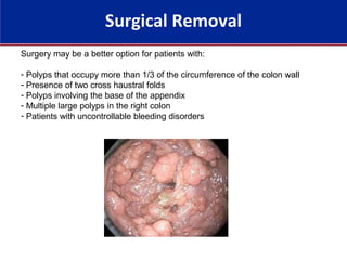 Surgical Removal
Surgery may be a better option for patients with:
- Polyps that occupy more than 1/3 of the circumference of the colon wall
- Presence of two cross haustral folds
- Polyps involving the base of the appendix
- Multiple large polyps in the right colon
- Patients with uncontrollable bleeding disorders
 