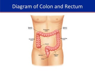 Diagram of Colon and Rectum
 