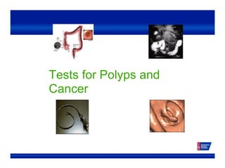 Tests for Polyps and
Cancer
 