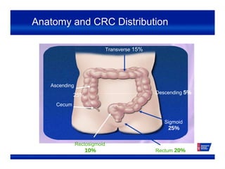 Anatomy and CRC Distribution
Transverse 15%
Ascending
25%
Cecum
Rectosigmoid
10%
Descending 5%
Sigmoid
25%
Rectum 20%
 