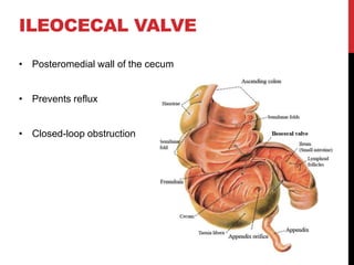 colon cancer full detailed presentation.pptx