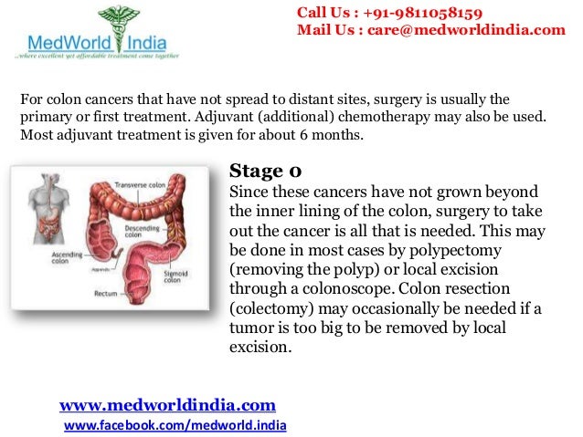 Colon Cancer Treatment by Stage