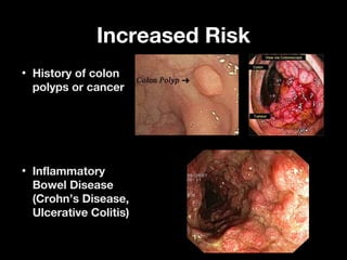 Increased RiskIncreased Risk
• History of colonHistory of colon
polyps or cancerpolyps or cancer
• InflammatoryInflammatory
Bowel DiseaseBowel Disease
(Crohn’s Disease,(Crohn’s Disease,
Ulcerative Colitis)Ulcerative Colitis)
 