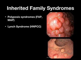 Inherited Family SyndromesInherited Family Syndromes
• Polyposis syndromes (FAP,Polyposis syndromes (FAP,
MAP)MAP)
• Lynch Syndrome (HNPCC)Lynch Syndrome (HNPCC)
 