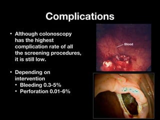 ComplicationsComplications
• Although colonoscopyAlthough colonoscopy
has the highesthas the highest
complication rate of allcomplication rate of all
the screening procedures,the screening procedures,
it is still low.it is still low.
• Depending onDepending on
interventionintervention
• Bleeding 0.3-5%Bleeding 0.3-5%
• Perforation 0.01-6%Perforation 0.01-6%
 