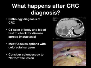 What happens after CRCWhat happens after CRC
diagnosis?diagnosis?
• Pathology diagnosis ofPathology diagnosis of
CRCCRC
• CT scan of body and bloodCT scan of body and blood
test to check for diseasetest to check for disease
spread (metastasis)spread (metastasis)
• Meet/Discuss options withMeet/Discuss options with
colorectal surgeoncolorectal surgeon
• Consider colonoscopy toConsider colonoscopy to
“tattoo” the lesion“tattoo” the lesion
 