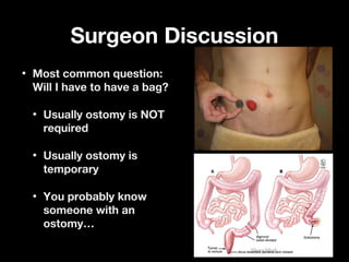 Surgeon DiscussionSurgeon Discussion
• Most common question:Most common question:
Will I have to have a bag?Will I have to have a bag?
• Usually ostomy is NOTUsually ostomy is NOT
requiredrequired
• Usually ostomy isUsually ostomy is
temporarytemporary
• You probably knowYou probably know
someone with ansomeone with an
ostomy…ostomy…
 