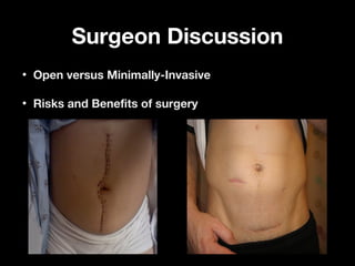 Surgeon DiscussionSurgeon Discussion
• Open versus Minimally-InvasiveOpen versus Minimally-Invasive
• Risks and Benefits of surgeryRisks and Benefits of surgery
 