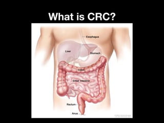 What is CRC?What is CRC?
 