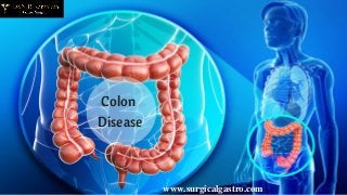 Colon
Disease
www.surgicalgastro.com
 
