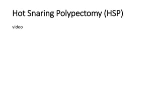 Hot Snaring Polypectomy (HSP)
video
 