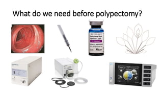 What do we need before polypectomy?
 