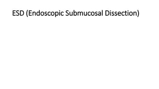 ESD (Endoscopic Submucosal Dissection)
 