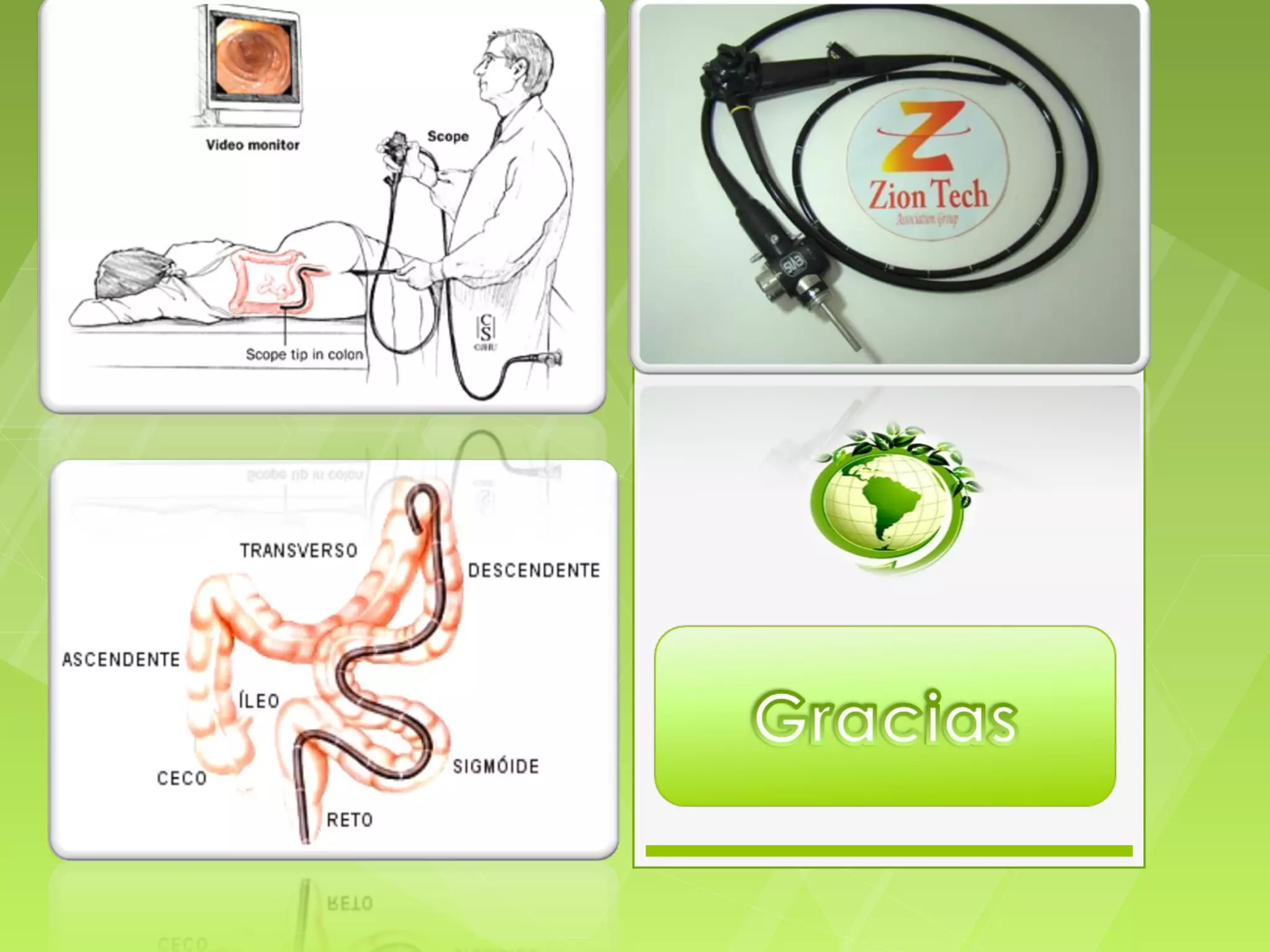 Colonoscopia | PPT