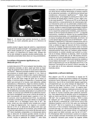 Colonoscopia Virtual | PDF